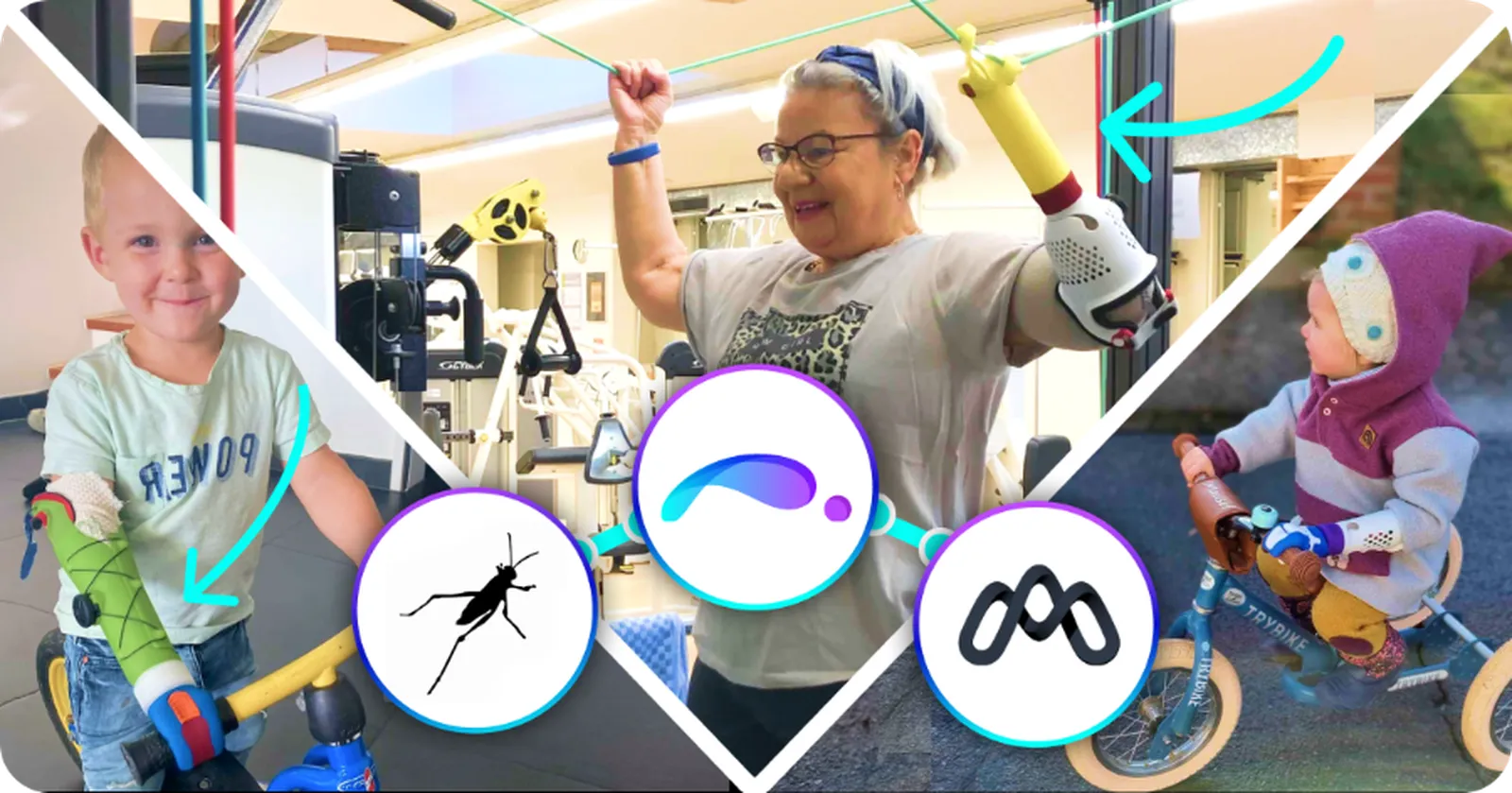 Getting to know... macu4: 3D Printed Arm Prosthetics!